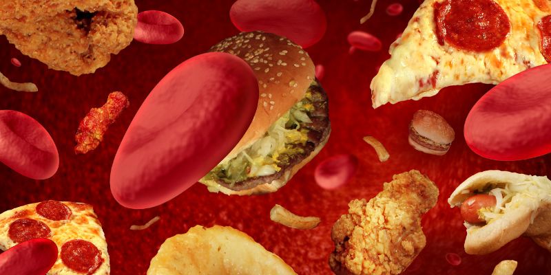 Cholesterolis aterolip