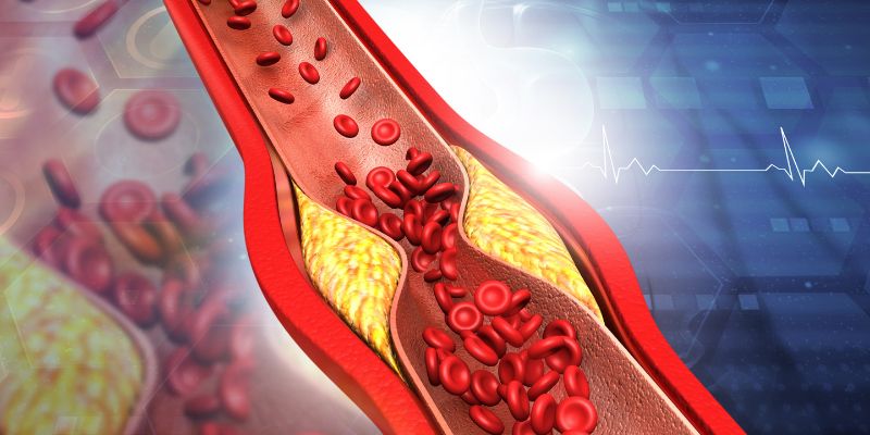 Padidėjęs cholesterolis Monakolinas K